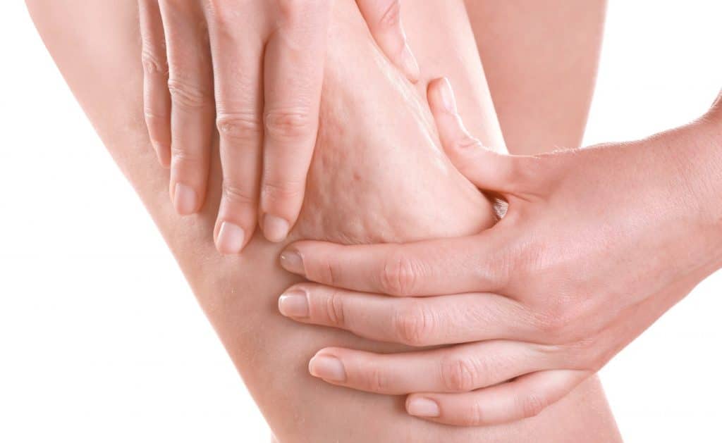 Cellulite Reduction