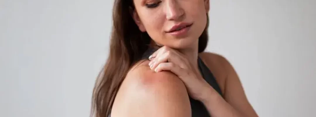 Woman with Sensitive Skin suffering from rash